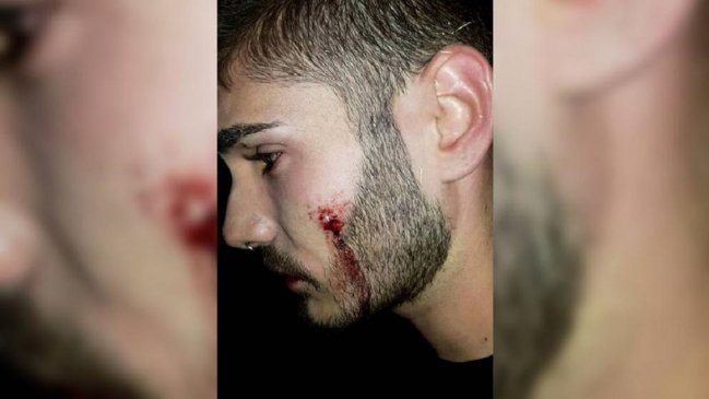 Denuncian agresión a joven gay por besar a su pololo en una discoteca