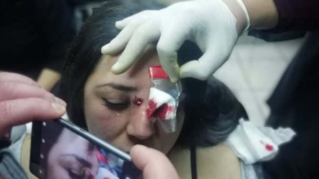 Carabineros revisará protocolo de actuación tras denuncia de alumna herida con perdigones