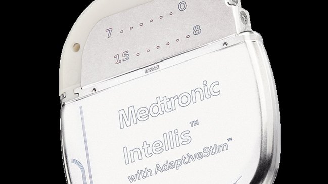 Chilena controla su dolor crónico con el dispositivo más pequeño del mundo