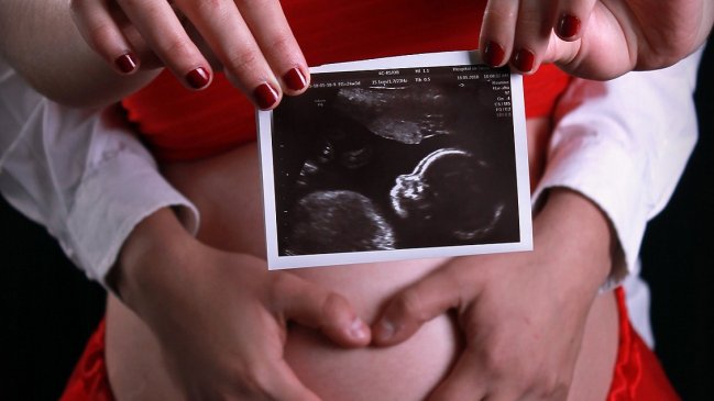  Imprimieron cara de un bebé en 3D para sus padres no videntes  