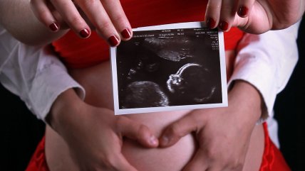  Imprimieron cara de un bebé en 3D para sus padres no videntes  