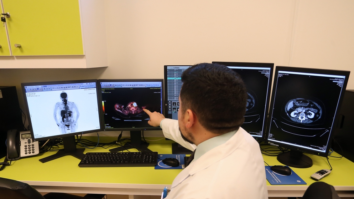 La enfermedad asociada a tratamientos del cáncer de la que poco se habla