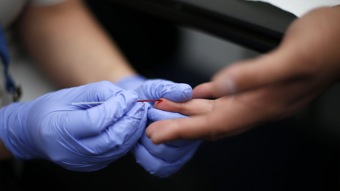 Tarapacá implementará una estrategia masiva de detección de VIH con test rápidos