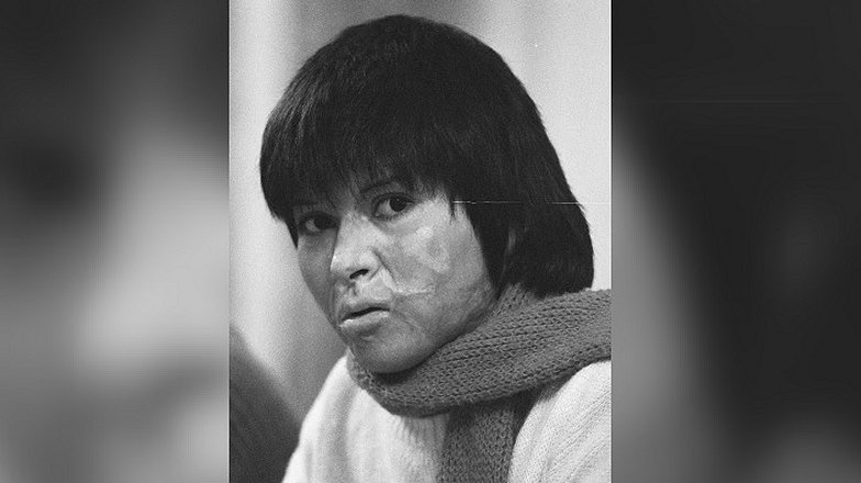 Imagen foto_00000016