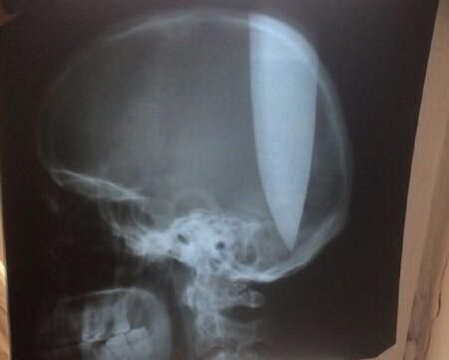 Imagen foto_00000002