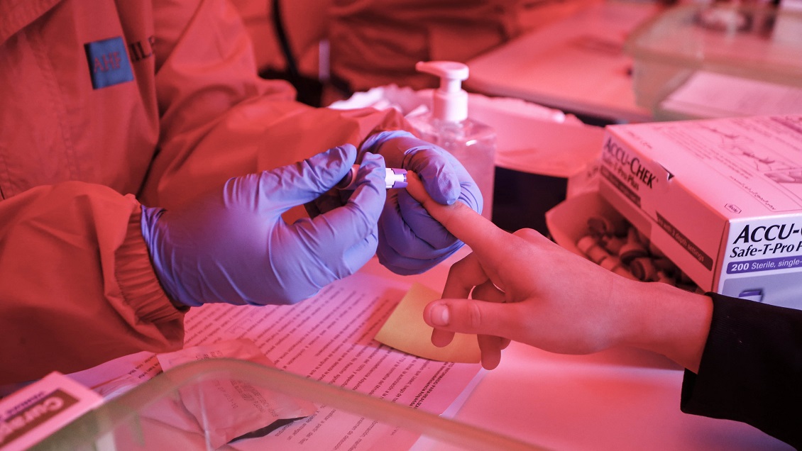 Logran eliminar el VIH en seis pacientes con trasplantes de células madre