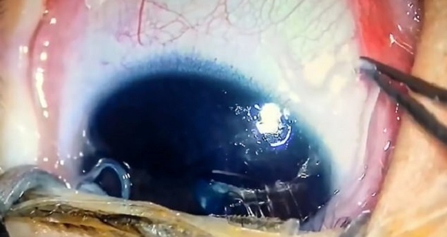 Imagen foto_00000002