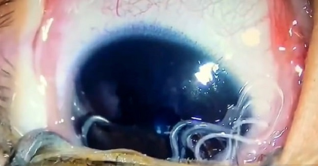 Imagen foto_00000003