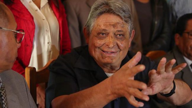 Bolivia: Candidato opositor propone olvidar la 