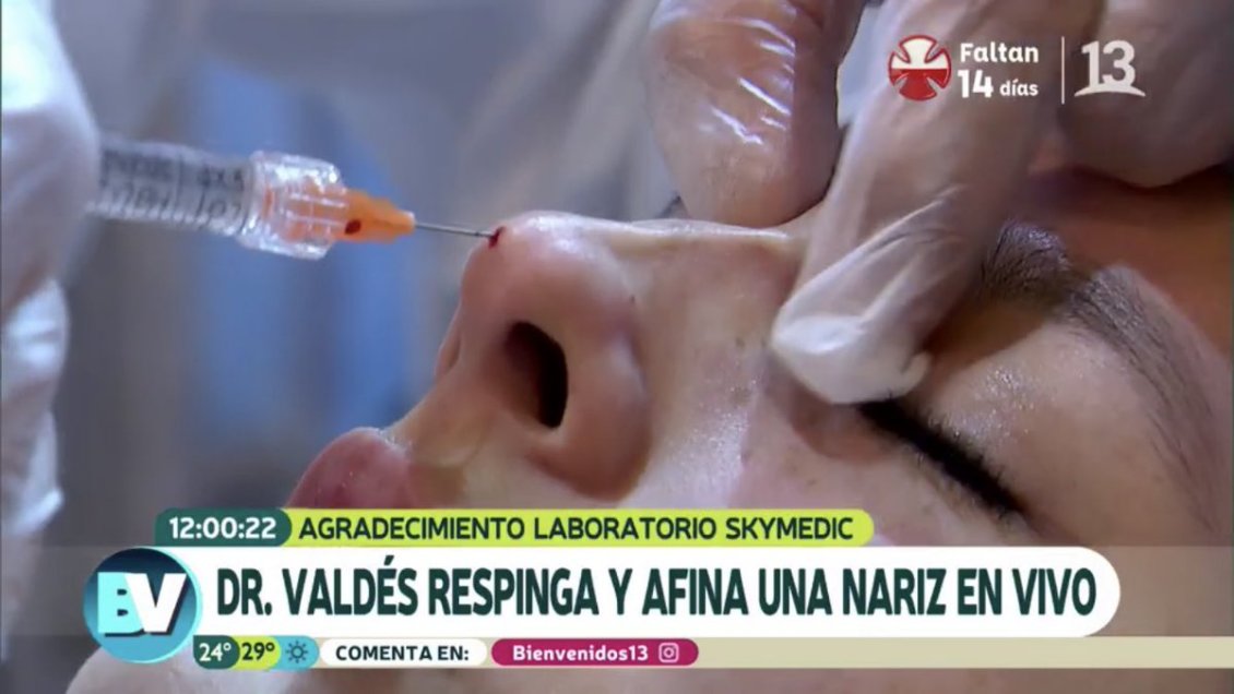 Duras críticas a intervención estética en vivo en 