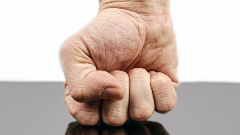 Joven denunció brutal golpiza de su ex pareja, con complicidad de sus padres