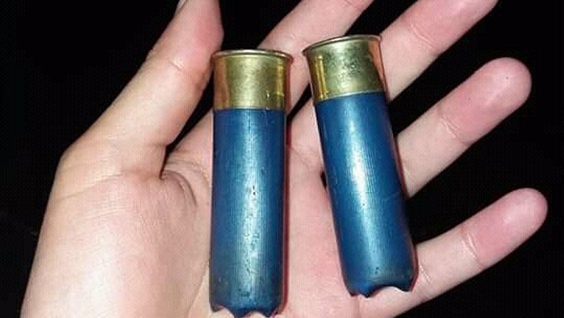 Menor recibió dos impactos de perdigones durante manifestación en Concepción