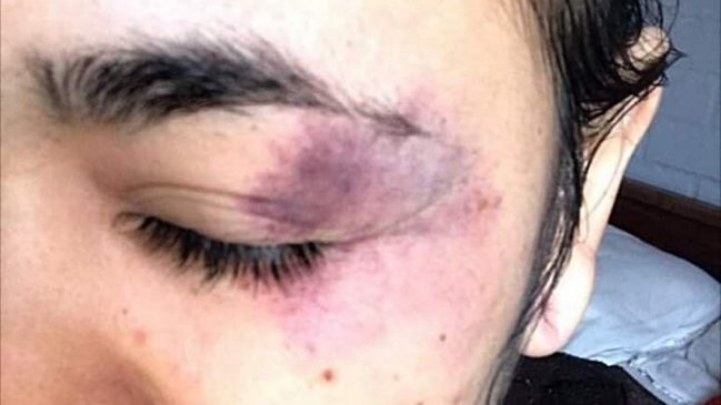 Denuncian torturas, abuso de poder y detenciones ilegales en Providencia