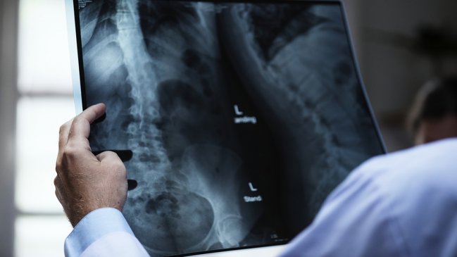 Investigación periodística denunció fallos en sistema de implantes médicos a nivel mundial