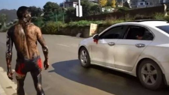 Hombre arrancó de su despedida de soltero y terminó herido de gravedad