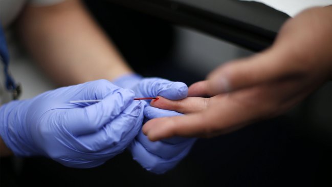 Chile: Entre los 10 países con mayor aumento de VIH