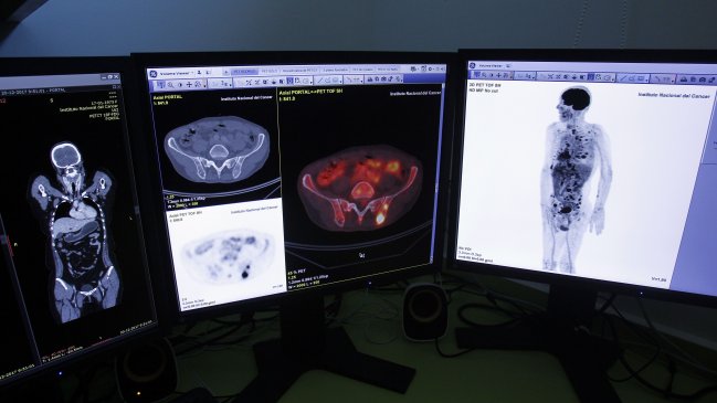 Déficit de oncólogos llega al 65 por ciento en el sistema público