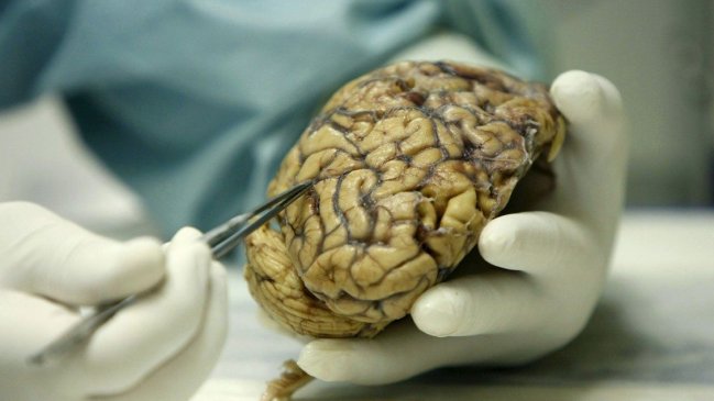  Científicos chilenos descubren forma para frenar progreso del Alzheimer  