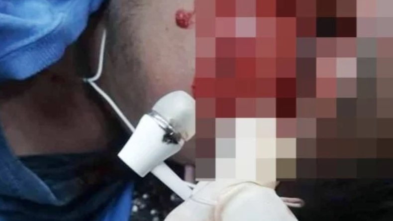 Joven se quedó dormido con los audífonos puestos y lo encontraron muerto