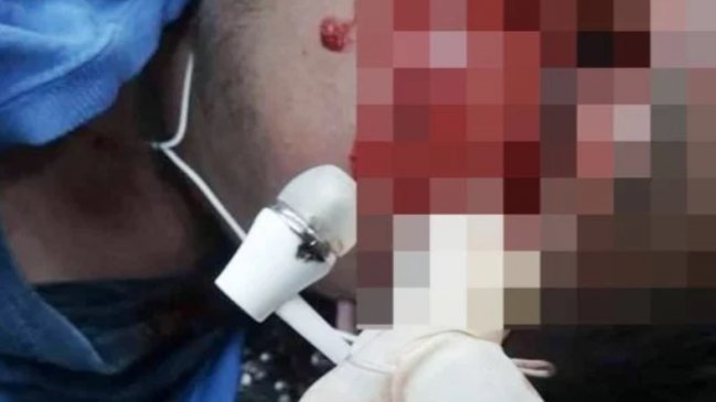 Joven se quedó dormido con los audífonos puestos y lo encontraron muerto