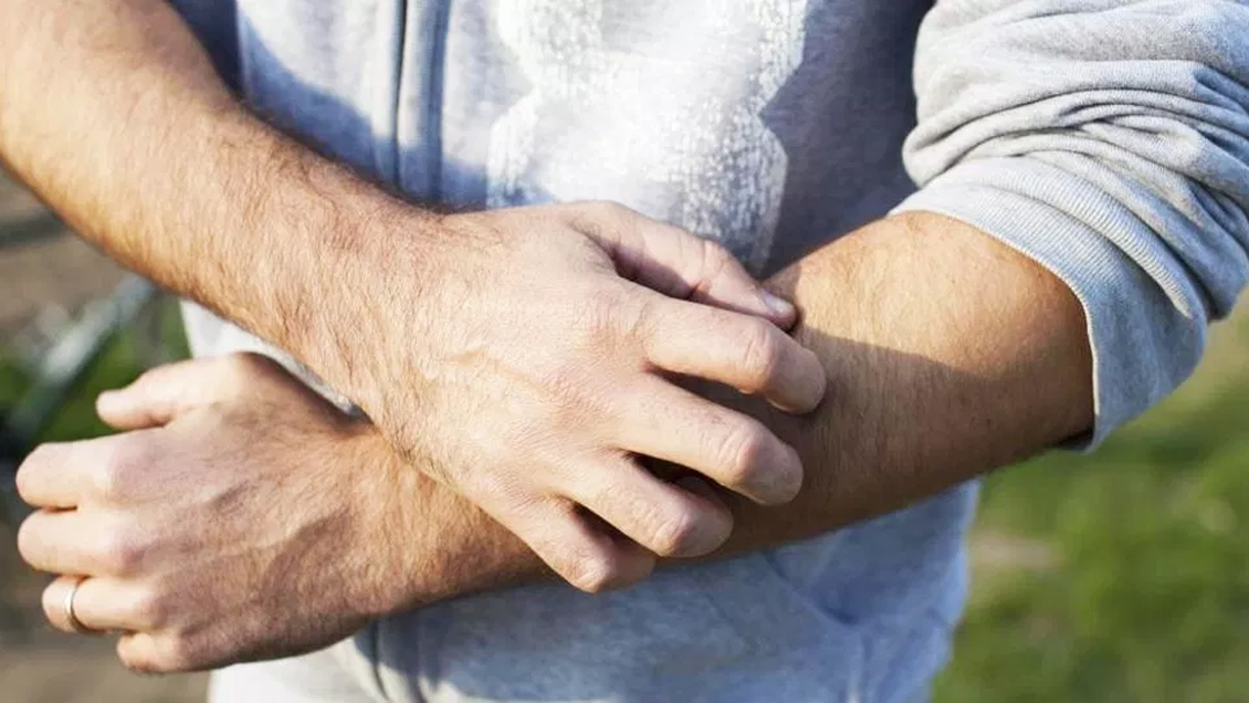 Identifican el mecanismo del cerebro que induce a rascarnos