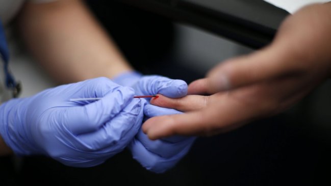 Aplican examen de VIH a 140 jóvenes de Valdivia