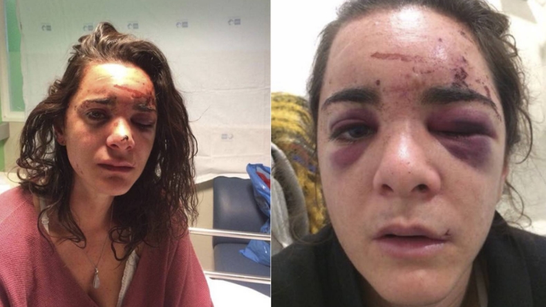 Imagen foto_00000002