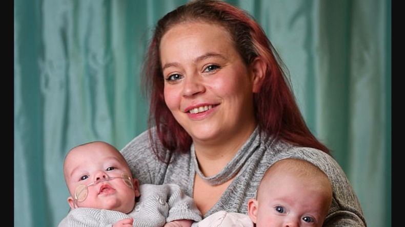 Mujer no sabía que estaba embarazada y tuvo a mellizas con 12 días de diferencia
