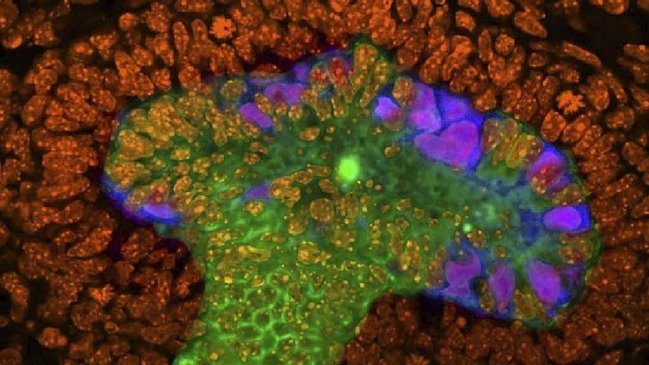 Amplían cobertura a trasplantes de células madres para afiliados a isapres