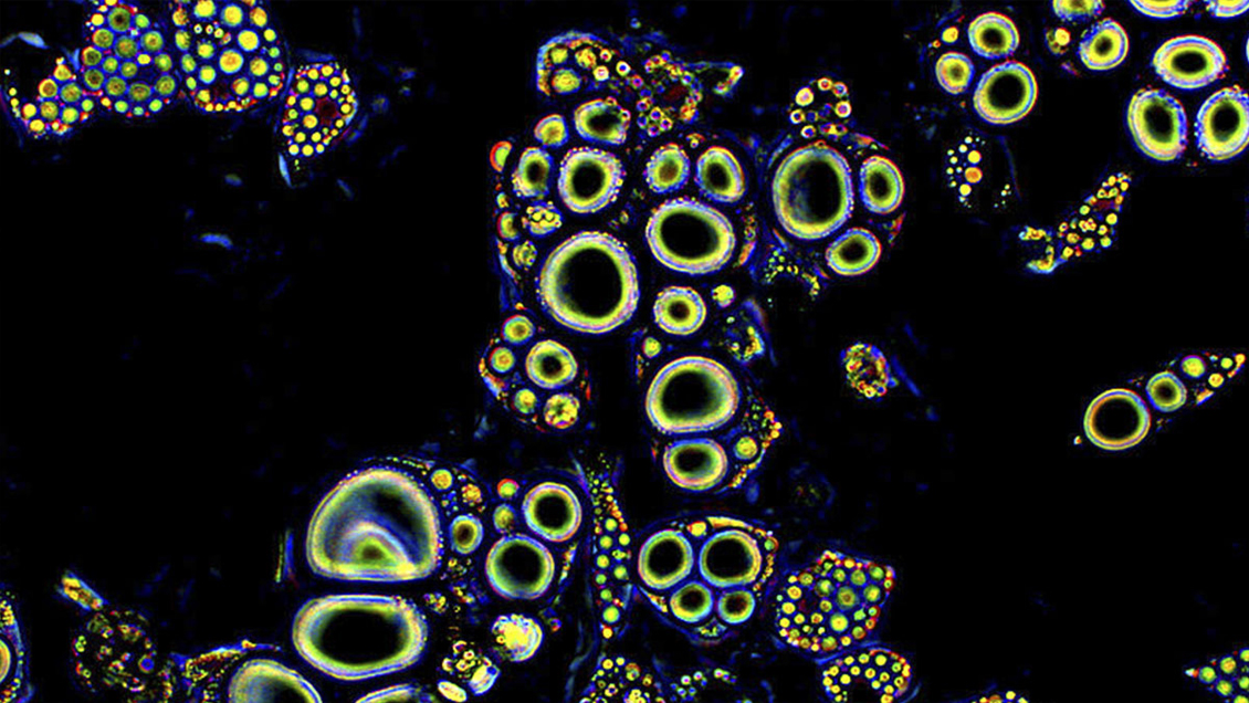 Japón probará células madre iPS para tratar lesiones de médula espinal