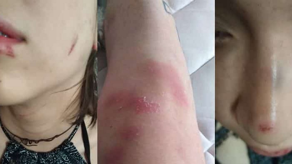 Pareja lésbica denunció brutal ataque homofóbico en Barrio Bellavista