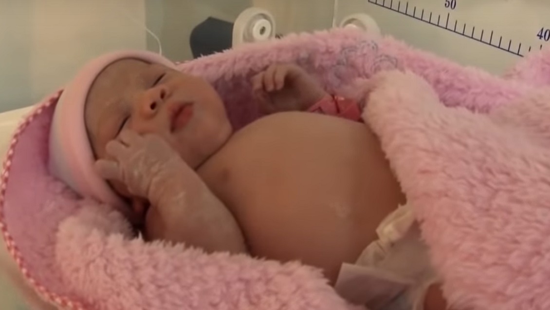 El extraño caso de una bebé que nació 