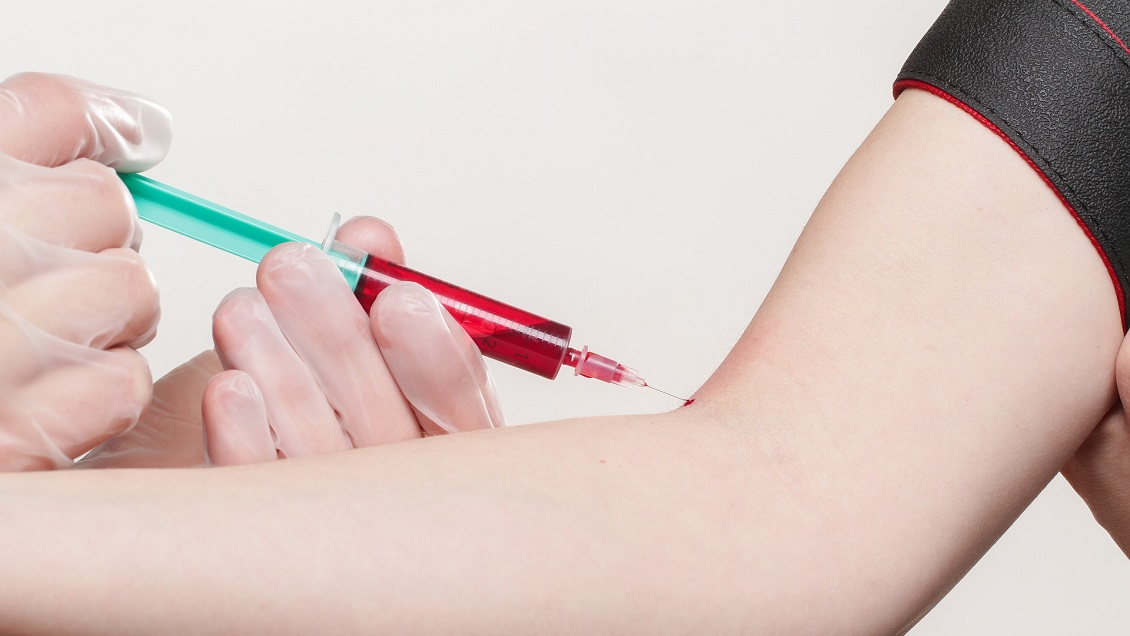 Mujer casi murió por inyectarse jugo de fruta en la sangre