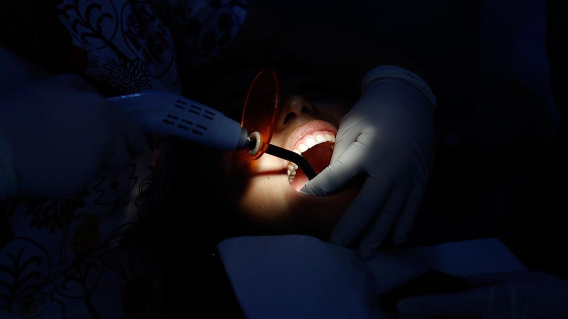 El 74 % de los mayores de 15 años tiene caries en Chile