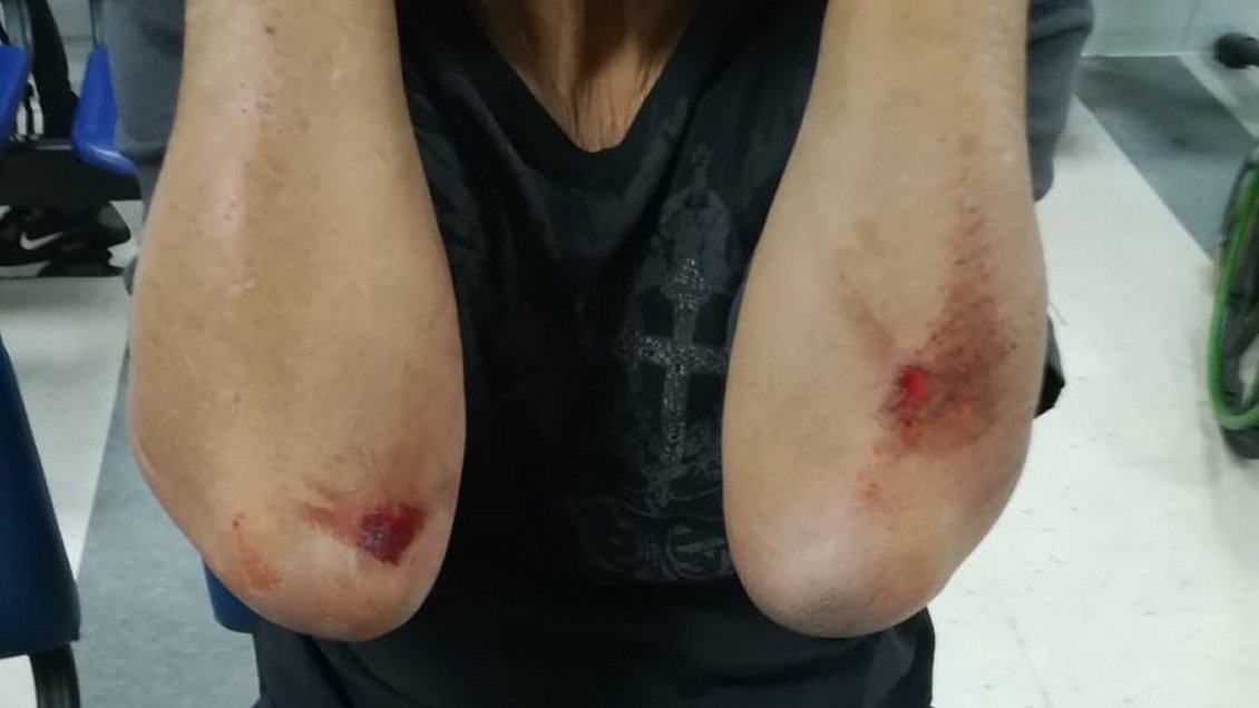 Violento portonazo dejó a un adulto mayor con múltiples lesiones