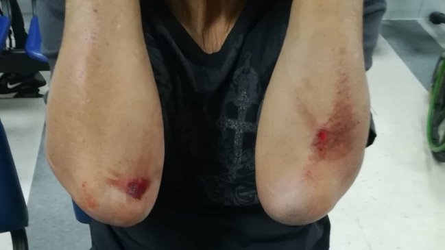 Violento portonazo dejó a un adulto mayor con múltiples lesiones