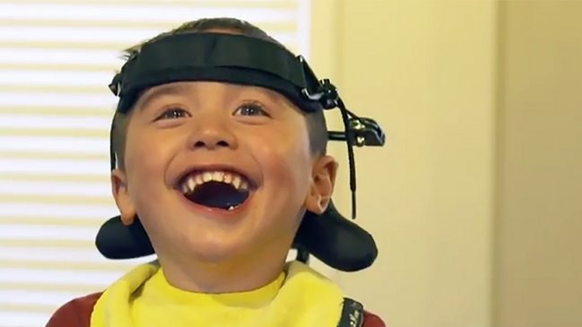 Niño se atragantó con una manzana y quedó paralítico