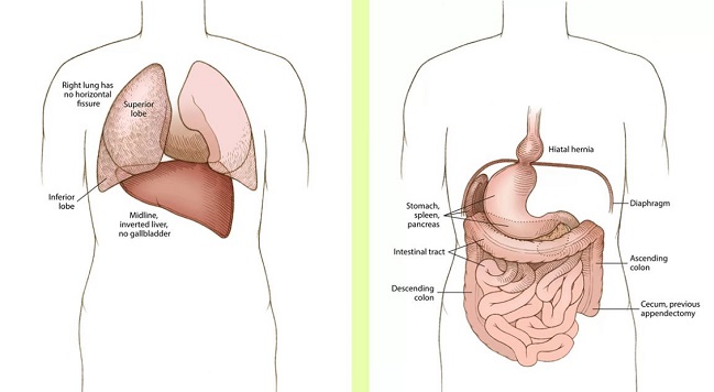 Imagen foto_00000001