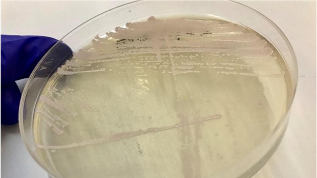 Reportan la primera aparición del peligroso hongo Candida auris en Chile