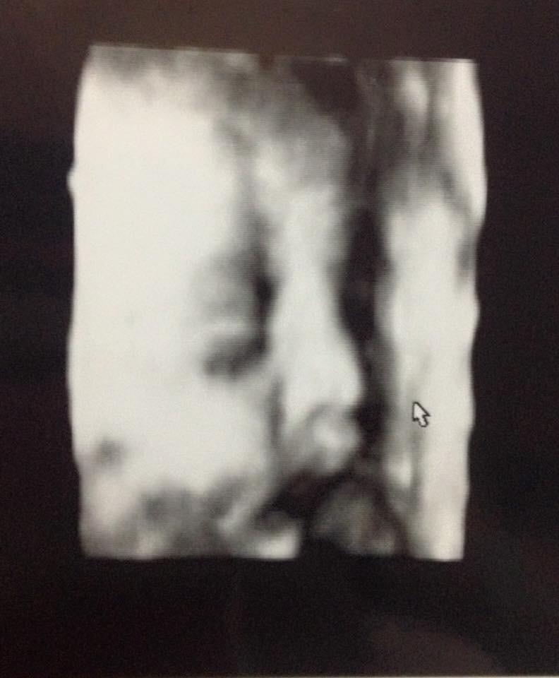 Imagen foto_00000002