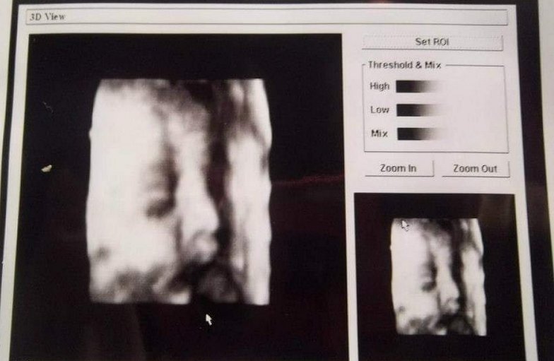 Imagen foto_00000016