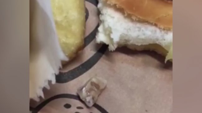 Cliente encontró diente humano en empanada de local de comida rápida
