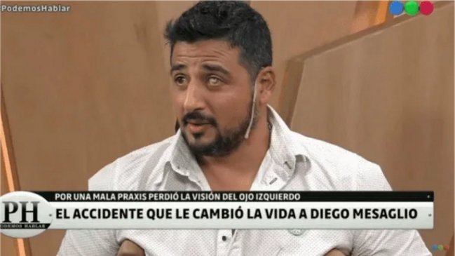 El conmovedor relato de actor argentino que perdió visión en un ojo