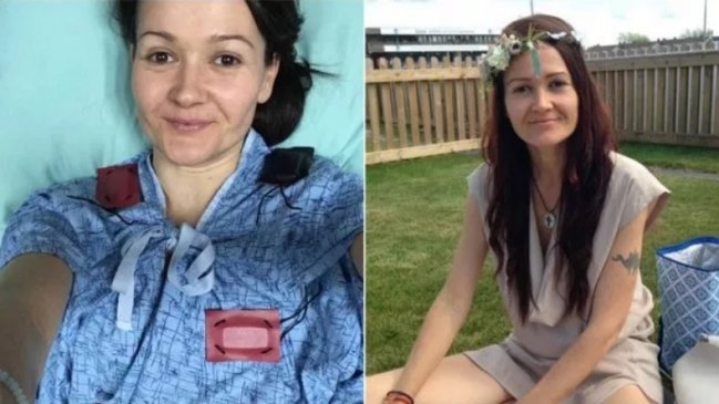 Una mujer murió de cáncer tras negarse a tratamientos normales y preferir dieta vegana