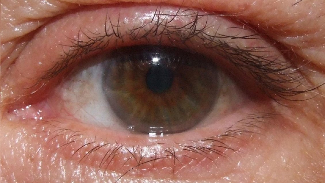 Corte condenó a médico y clínica oftalmológica por operación negligente