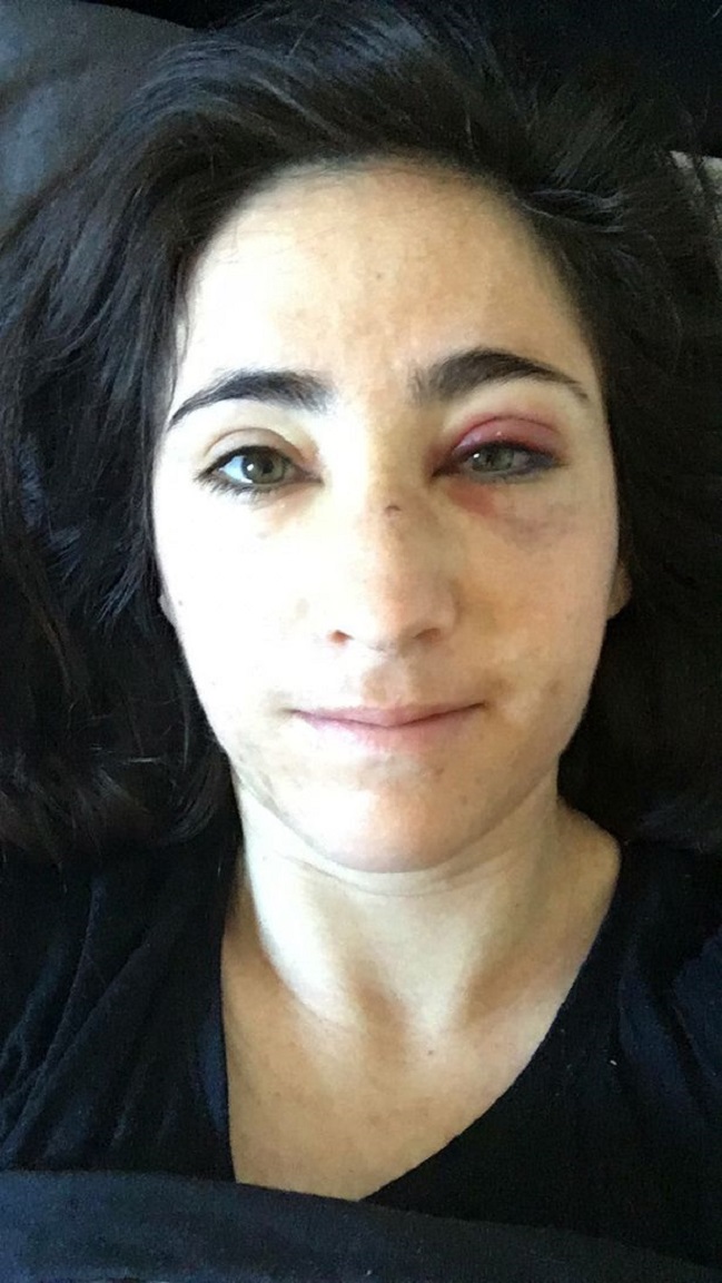 Imagen foto_00000003