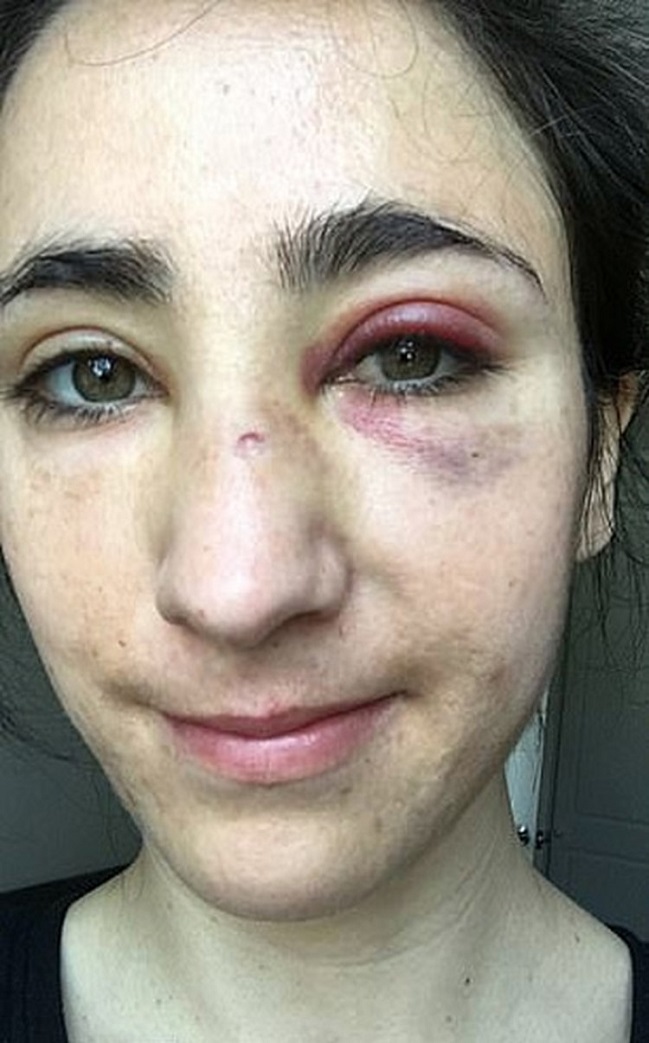 Imagen foto_00000005