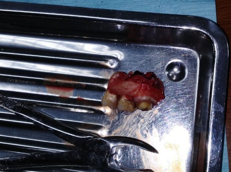 Imagen foto_00000017