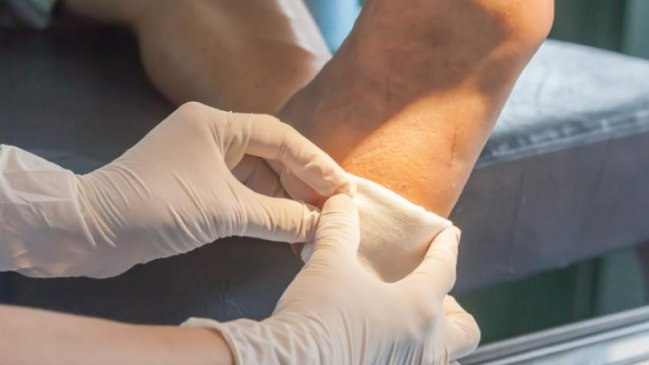 Médicos le amputaron la pierna equivocada a una mujer en Argentina