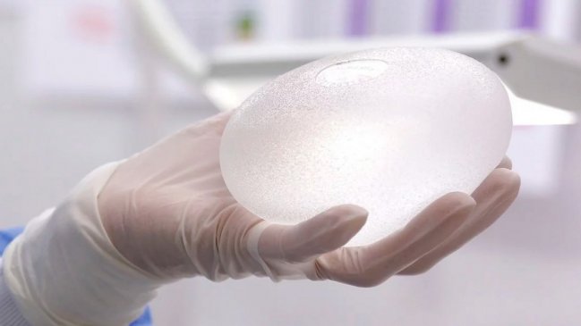 Retiran del mercado una marca de implantes mamarios por riesgos sanitarios